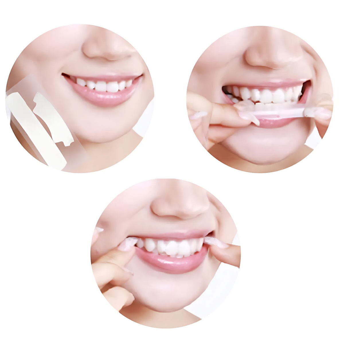 Smilumin – Thuiskit voor esthetische tandverzorging